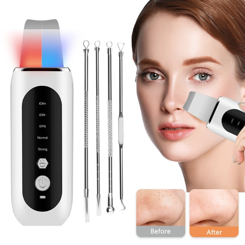 The Daily Lift Purify: Advanced Ultrasonic Deep Exfoliating Wand