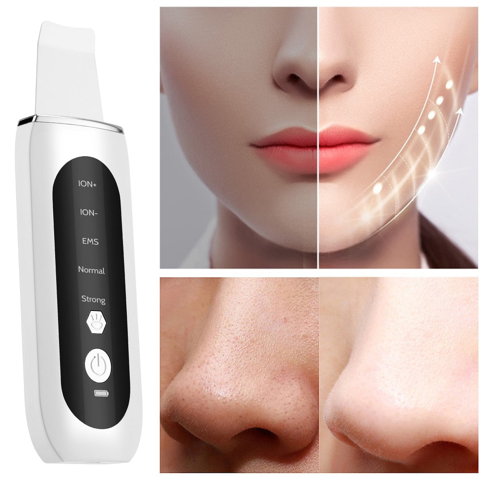 The Daily Lift Purify: Advanced Ultrasonic Deep Exfoliating Wand
